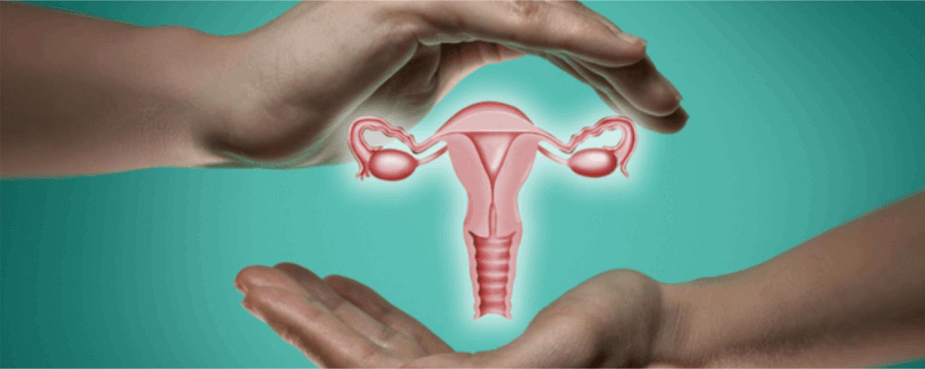 ovarian cancer
