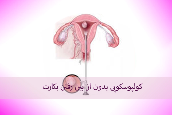 آیا کولپوسکوپی برای دختران باکره قابل انجام است؟