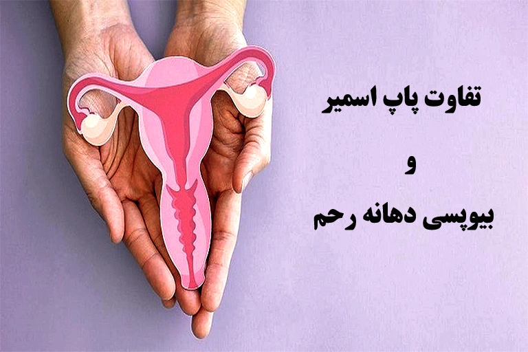 تفاوت پاپ اسمیر و بیوپسی دهانه رحم