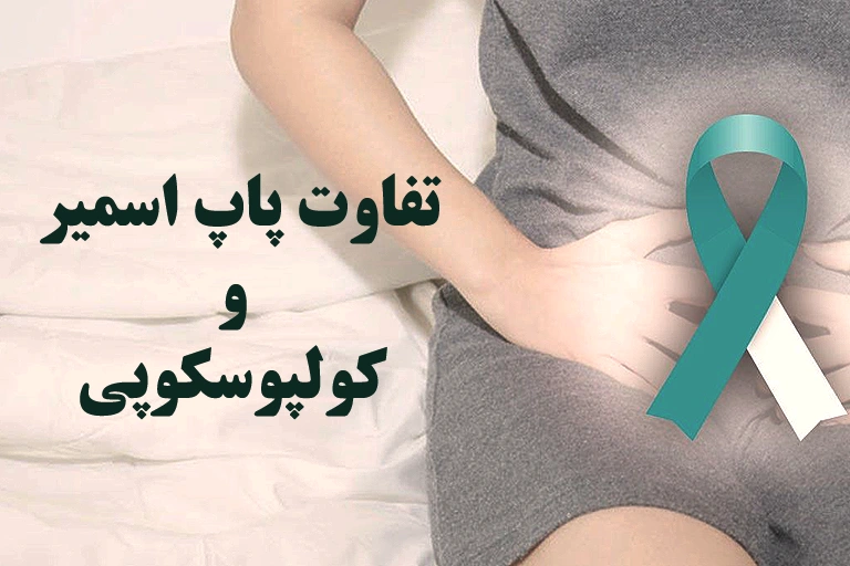 تفاوت پاپ اسمیر و کولپوسکوپی