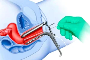 کلیات و ضرورت تست پاپ اسمیر