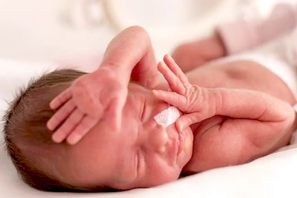 وزن کم نوزاد هنگام تولد