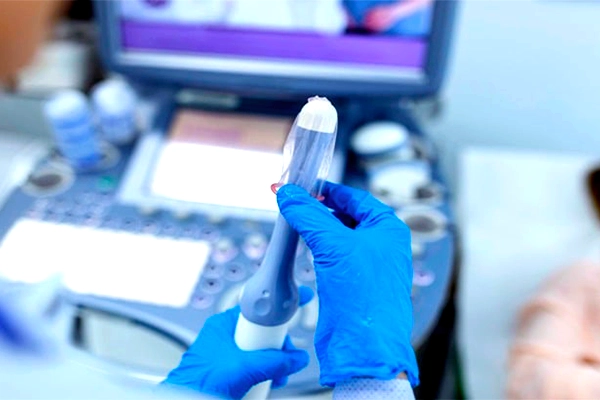 سونوگرافی ترانس‌واژینال