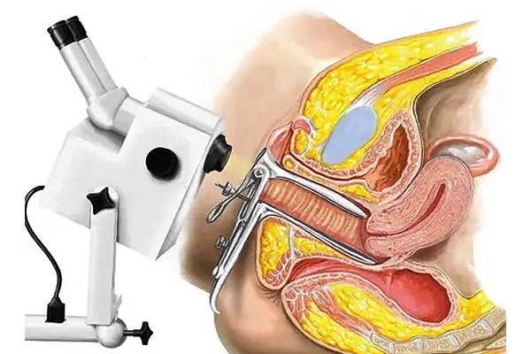 عوامل مؤثر در کیفیت و دقت کولپوسکوپی