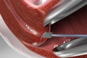 تست پاپ اسمیر در تهران