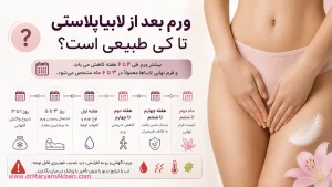 ورم بعد از لابیاپلاستی تا کی طبیعی است؟